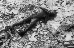 Жертва взрыва в Нагасаки