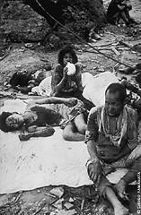 Раненые в Нагасаки